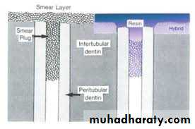 Dental Adhesion