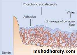 Dental Adhesion