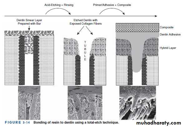 Dental Adhesion