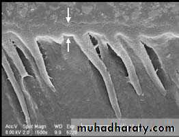 Dental Adhesion