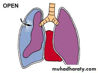 Chest injury