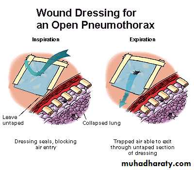 Chest injury