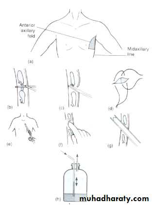 Chest injury