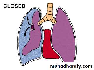 Chest injury