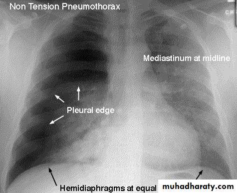 Chest injury
