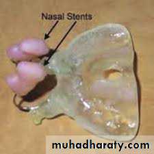 cleft lip and palate