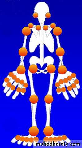 RA