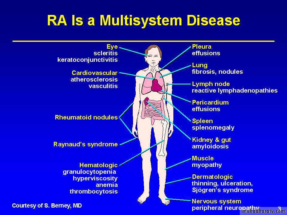 RA