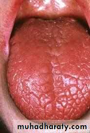 Salivary gland ppt