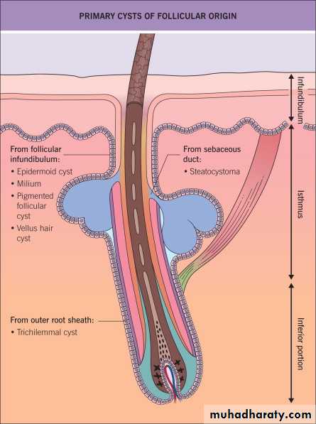 Skin Tumors