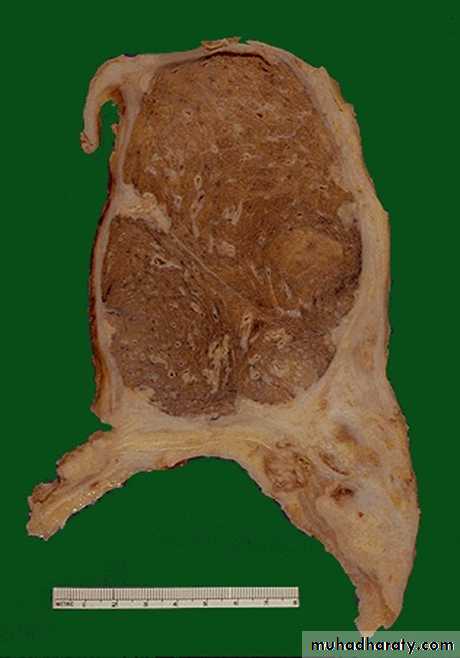 Respiratory system