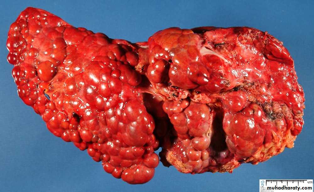 Liver and bone