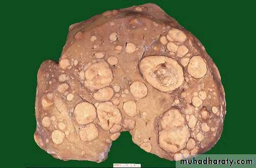 Liver and bone