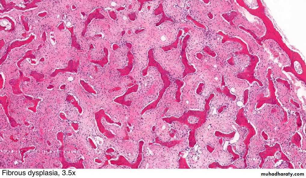 Liver and bone