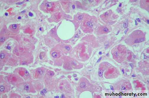 Liver and bone
