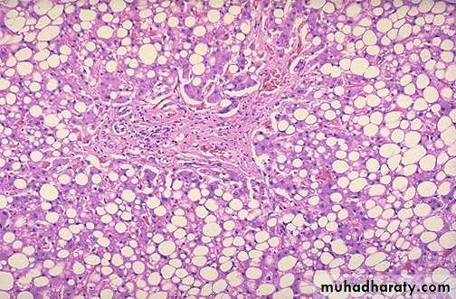 Liver and bone