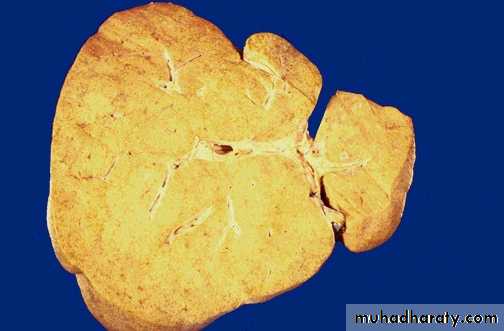 Liver and bone