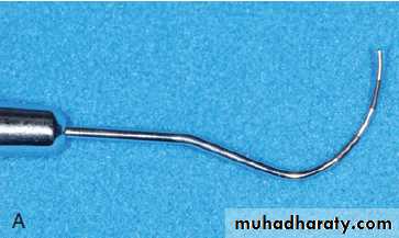 furcation involvement