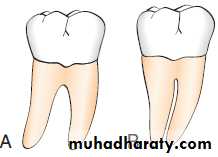 furcation involvement