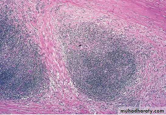 lymphreticular dentistry