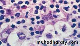 lymphreticular dentistry