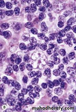 lymphreticular dentistry