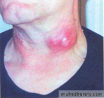 lymphreticular dentistry