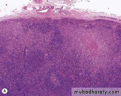 lymphreticular dentistry