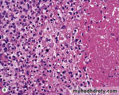 lymphreticular dentistry