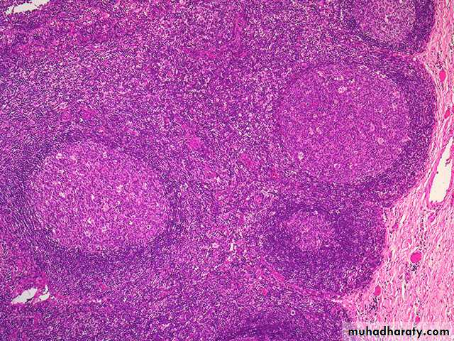 lymphreticular dentistry