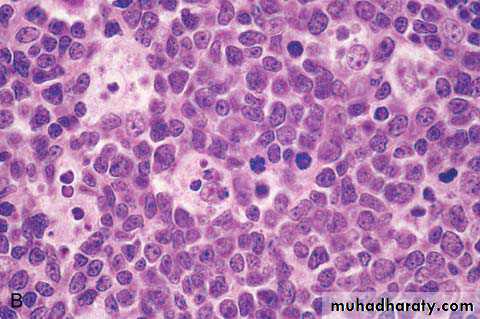 lymphreticular dentistry