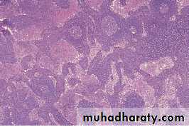 lymphreticular dentistry