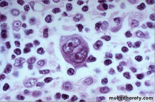 lymphreticular dentistry