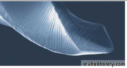 Niti instrument