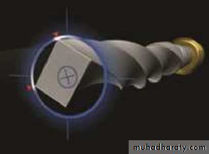 Niti instrument