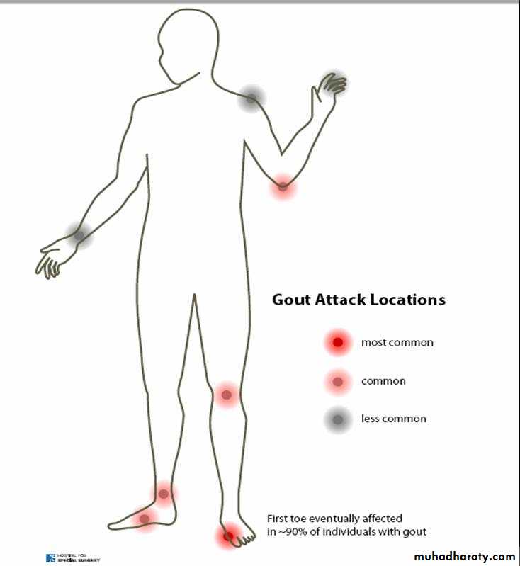 Gout