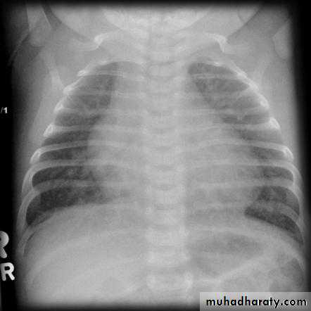 Cardiology