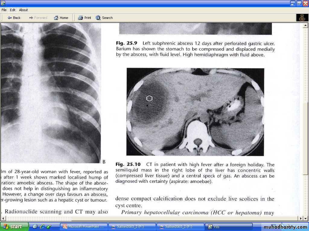 Liver& Biliary