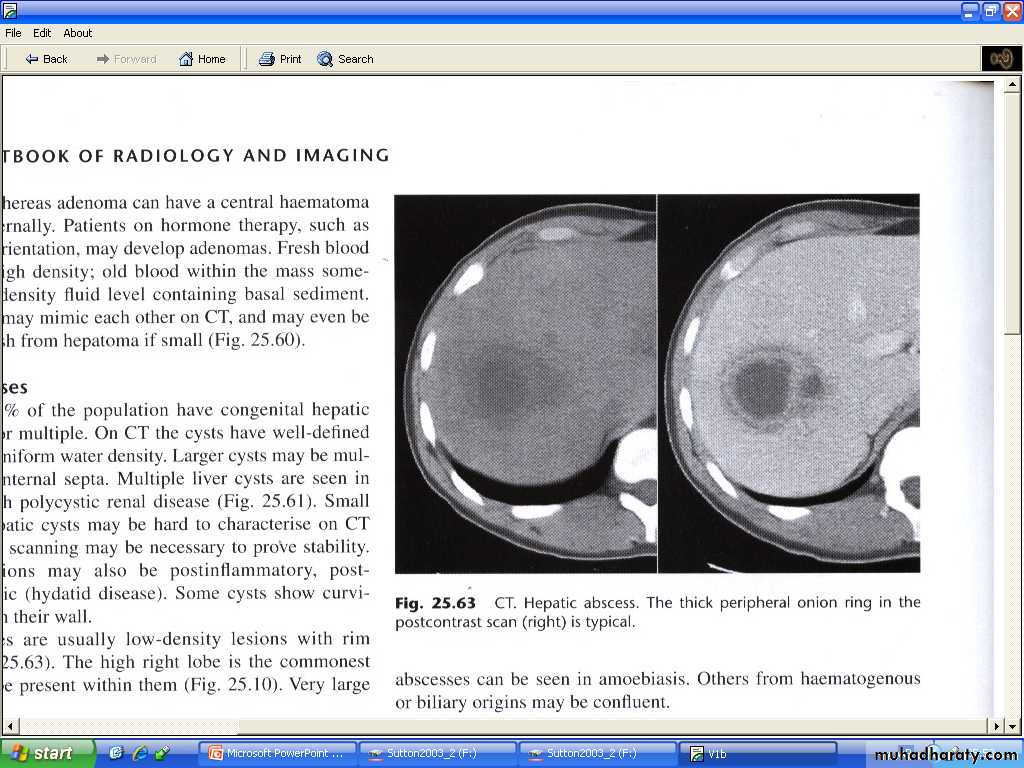 Liver& Biliary