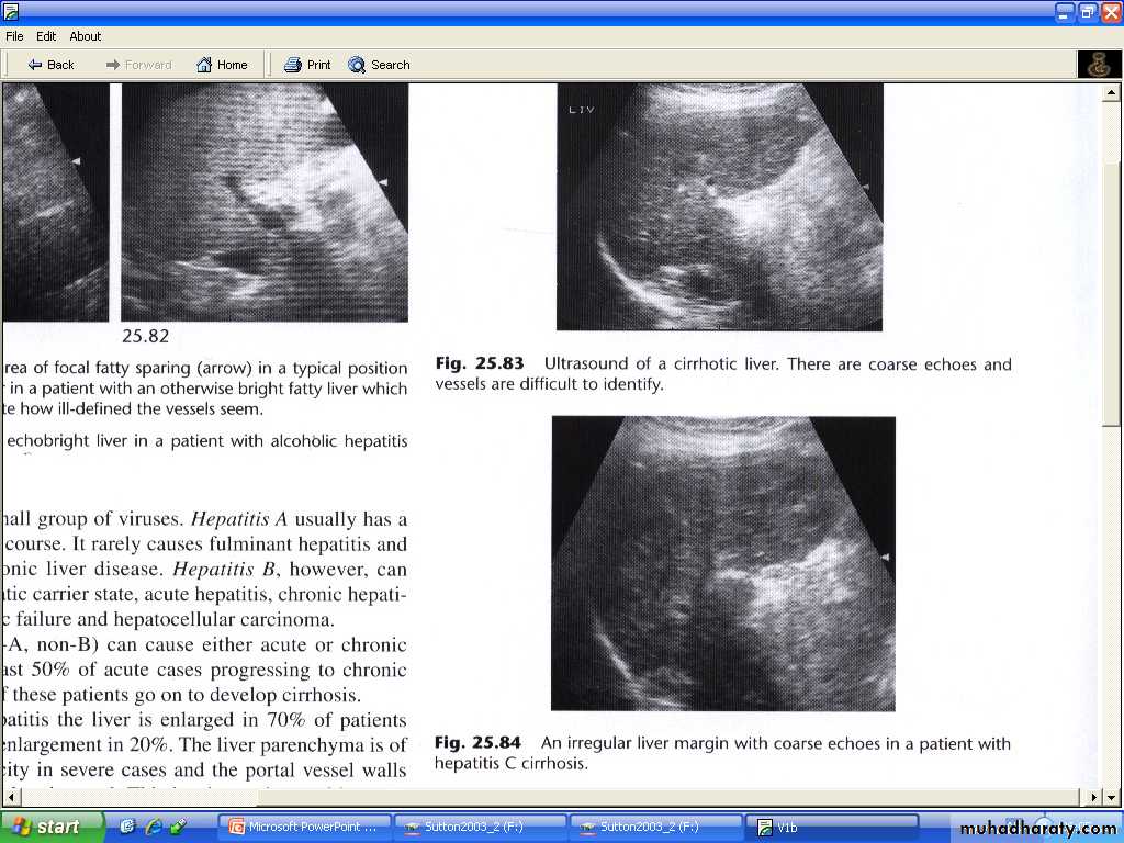 Liver& Biliary