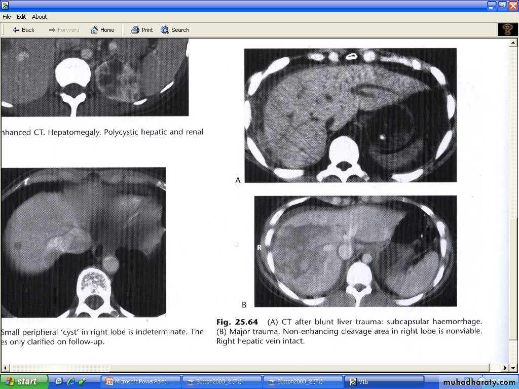 Liver& Biliary