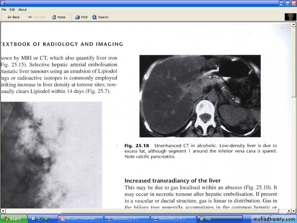 Liver& Biliary