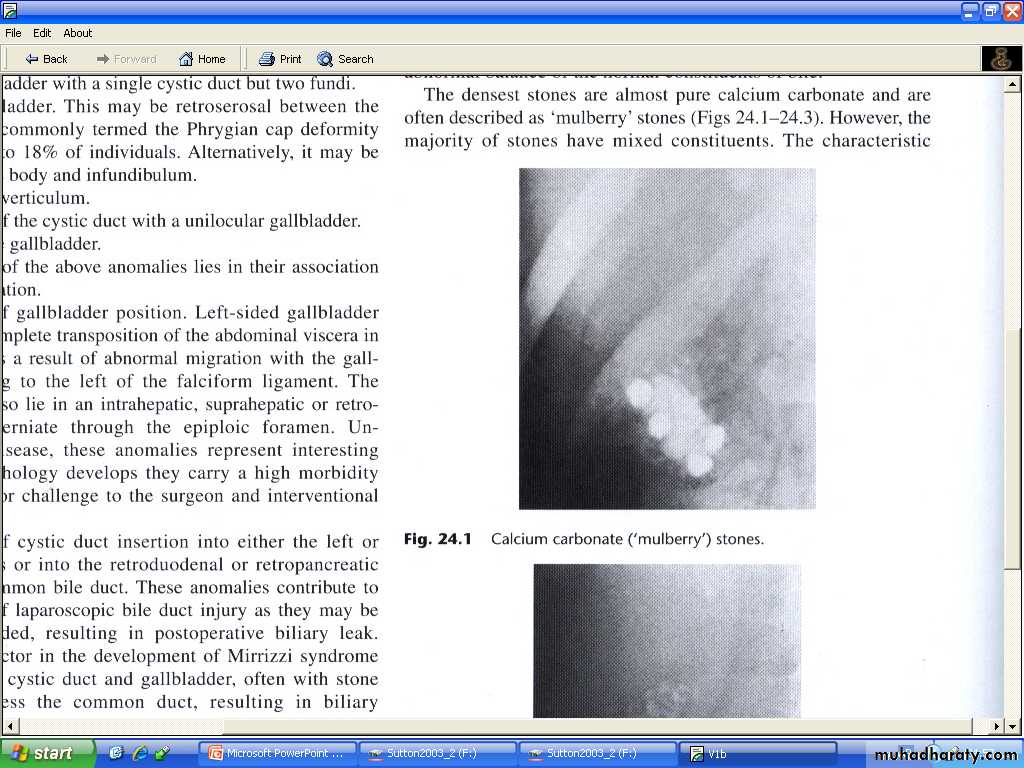 Liver& Biliary