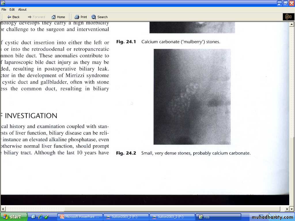 Liver& Biliary