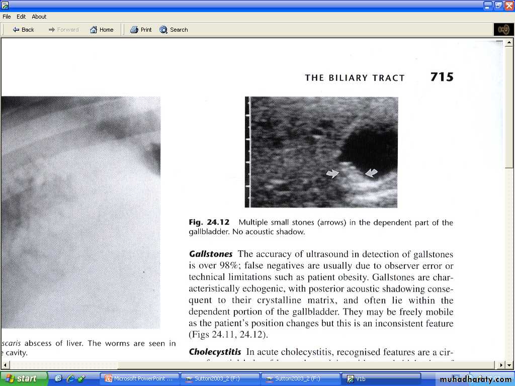 Liver& Biliary