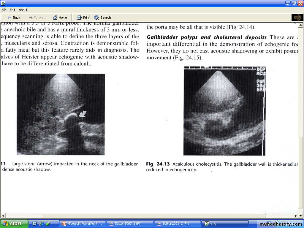 Liver& Biliary