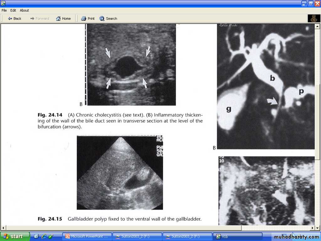 Liver& Biliary