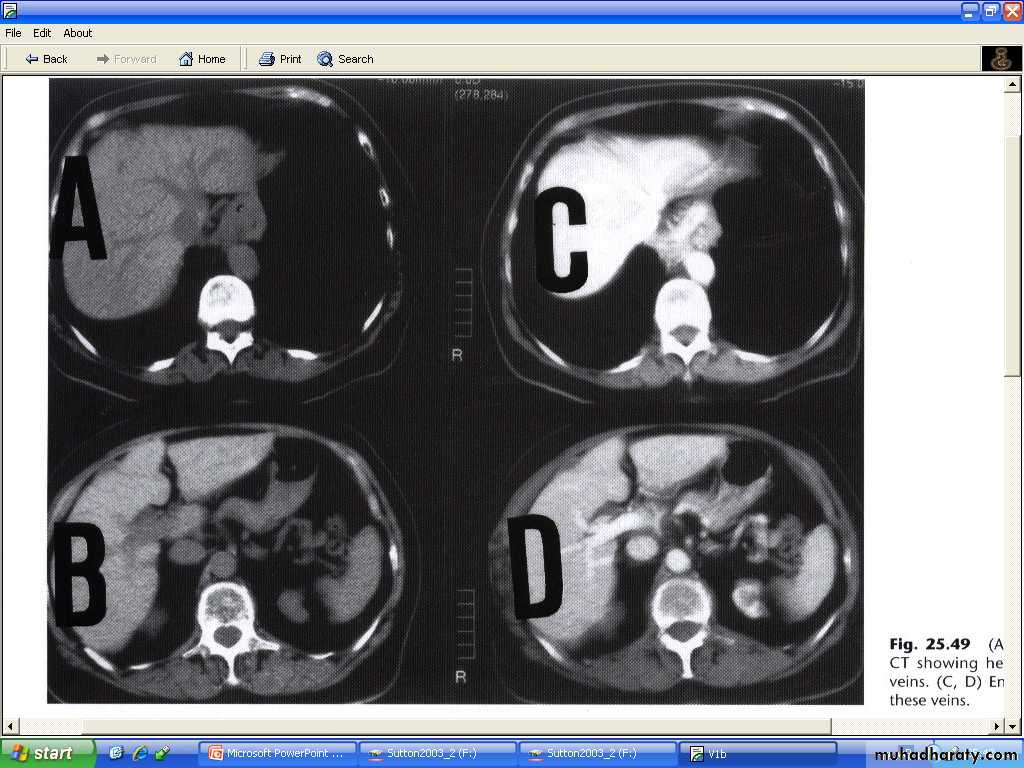 Liver& Biliary