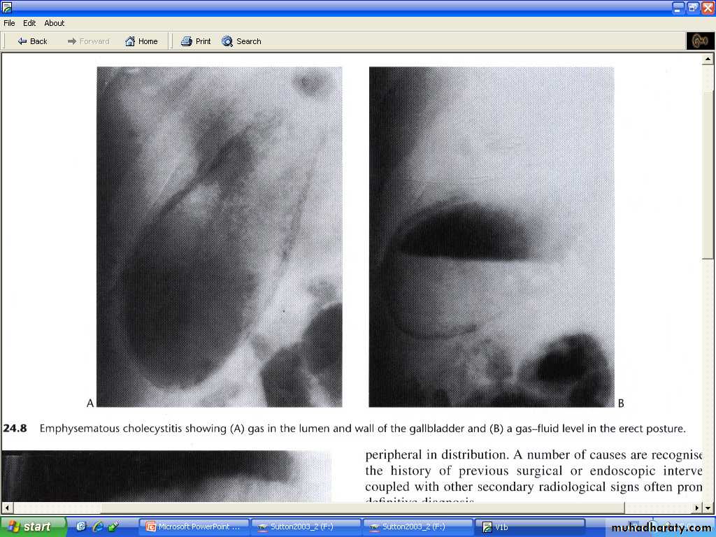 Liver& Biliary