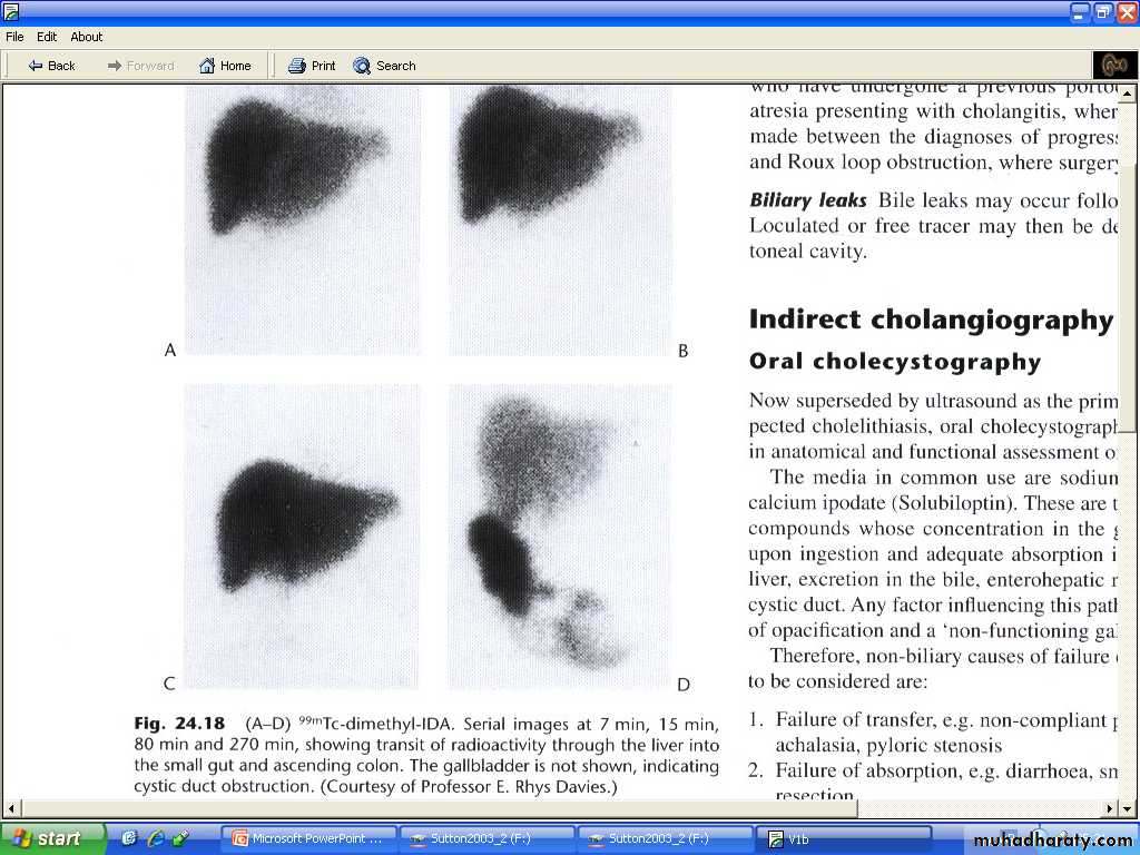 Liver& Biliary